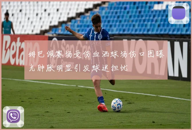 姆巴佩赛场受伤血洒球场伤口图曝光肿胀明显引发球迷担忧